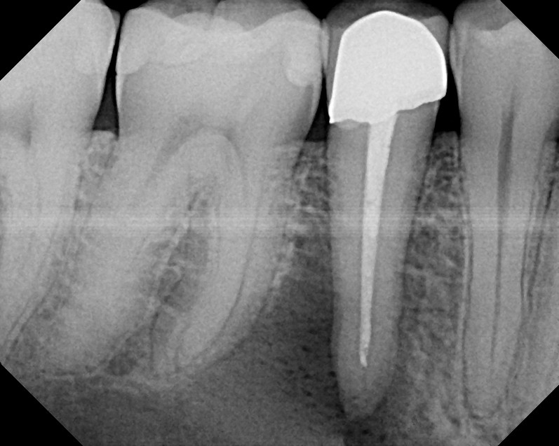 Методы лучевого исследования, применяемые в стоматологии